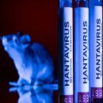 Hantavirus à bord du MV Hondius : une flambée rare fait trois morts et alerte les autorités sanitaires